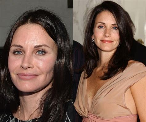 courteney cox boob job|Courteney Cox’s Plastic Surgery .